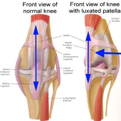 normal and luxated patella
