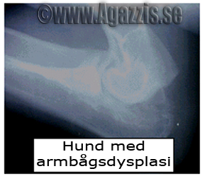 armbågsdysplasi