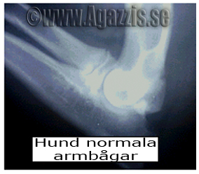 normala armbågar